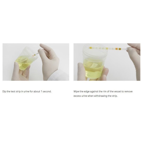 Combur 9 50 Test Strip - Image 2