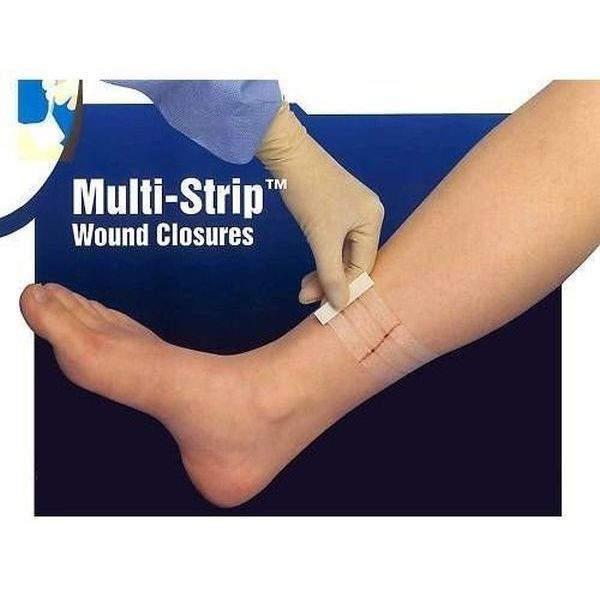 Multi-Strip Wound Strip 13mmx100mm Strip Of 6