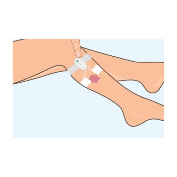 Accel Heal Solo - Image 2