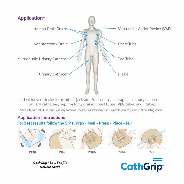 CathGrip Low Profile Double Strap Medium Non-Sterile with BioPlus Wipes - Image 3